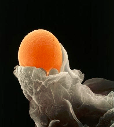 卵泡实物图图片