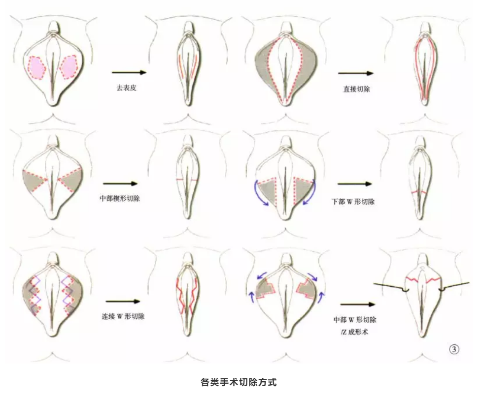 私密整形——为自己的"性"福做主