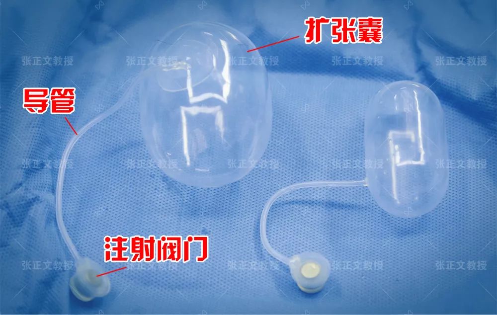 皮肤软组扩张器,是如何扩张皮肤的?