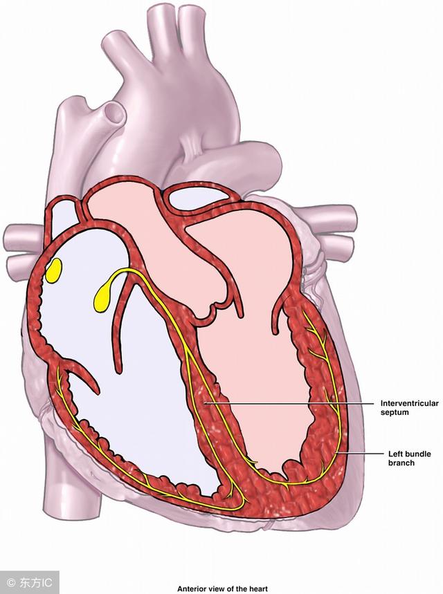 子宫内或新生儿期诊断的所有先天性完全性心脏传导阻滞病例中,80%-95%