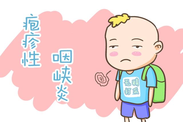 以急性发热和咽峡部疱疹溃疡为特征的急性传染性咽颊炎,以粪-口或呼吸