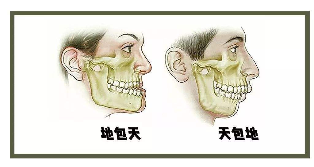 引起错颌畸形的原因有哪些?可以预防吗?