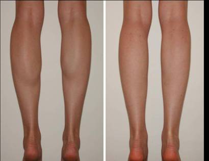 北京胡大夫和你一起关注网红新词"漫画腿"