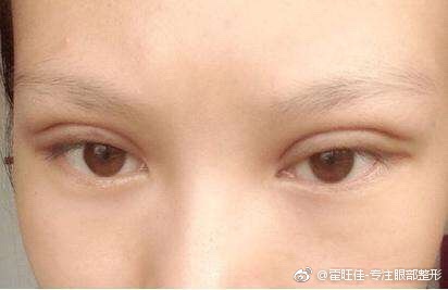 真假肉条眼分不清?点进来教你如何判断!