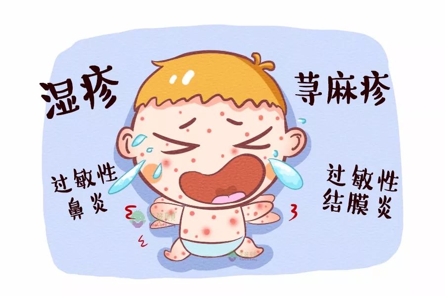 妈妈们看过来!全面认识宝宝春季过敏,这些措施让你从容应对! 妈妈们看过来!全面认识宝宝春季过敏,这些措施让你从容应对!