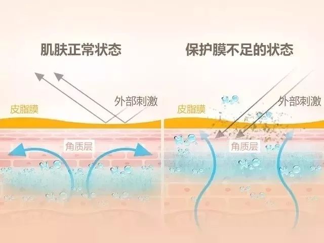 為啥爛臉的總是你?這是皮膚屏障受損的信號!