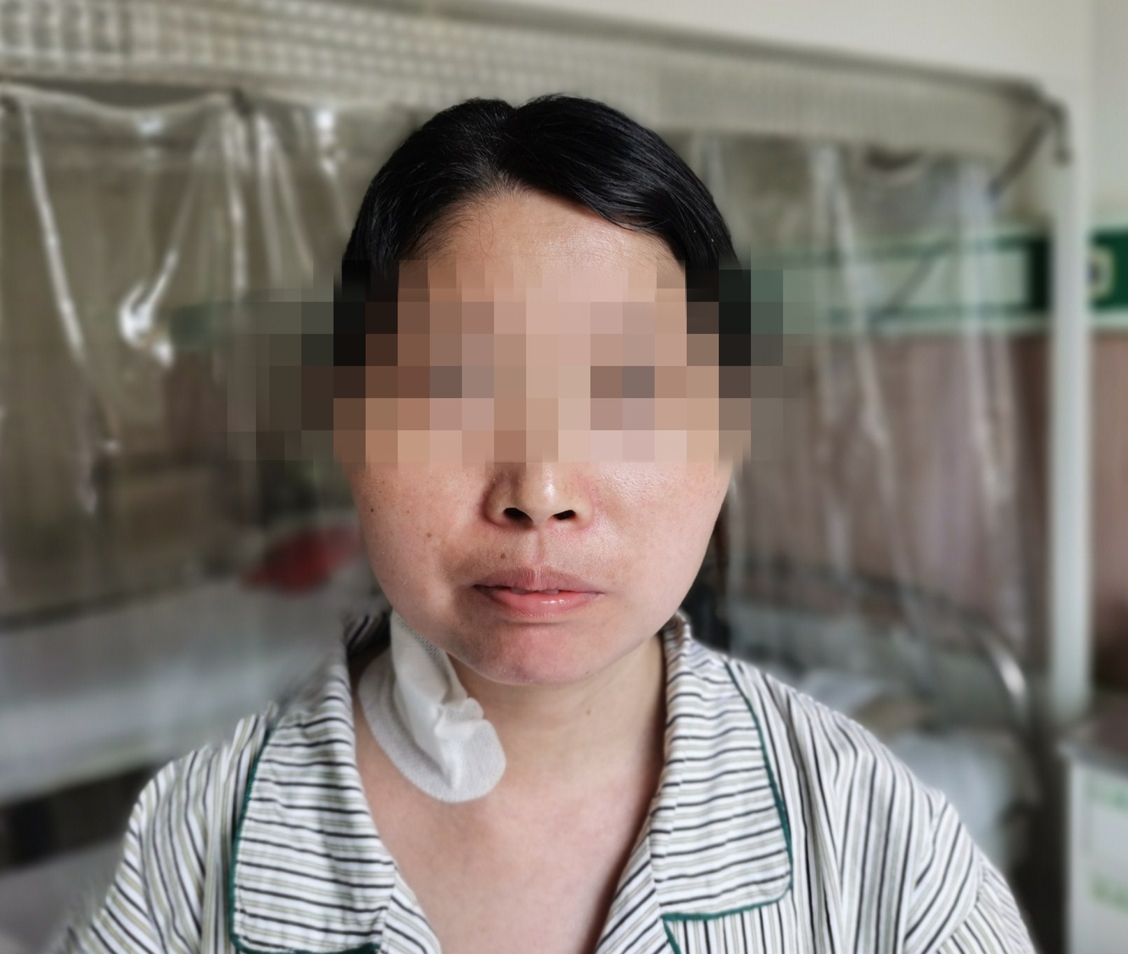 风湿免疫性疾病——解读系统性红斑狼疮 健康科普 -沧州市人民医院