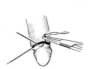 爱问健康_王平_副主任医师_爱问健康