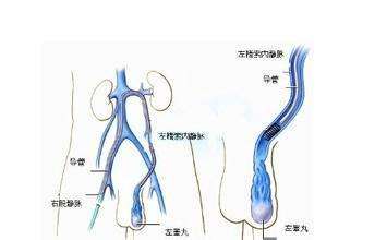 轻度 站立时看不到阴囊皮肤有曲张静脉突出