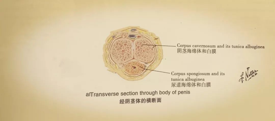 在勃起状态下,外在过强的暴力会使丁丁海绵体的 「白膜」破裂,从而
