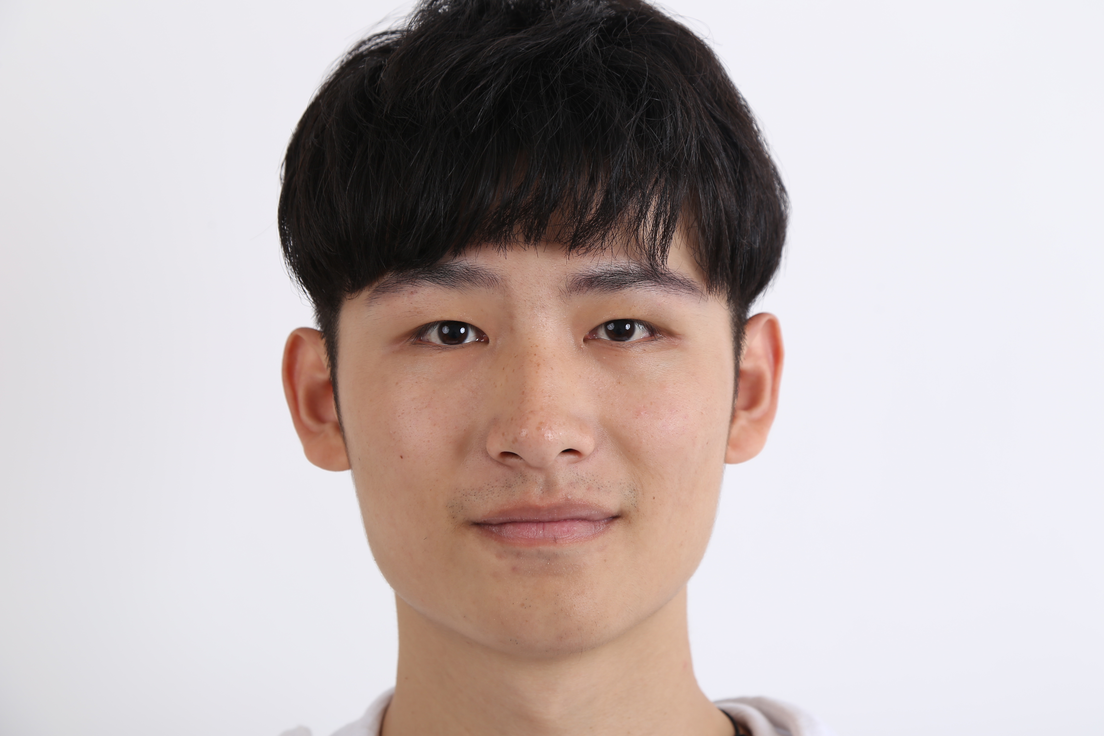 双眼皮值不值得做?他用亲身经历给你答案!