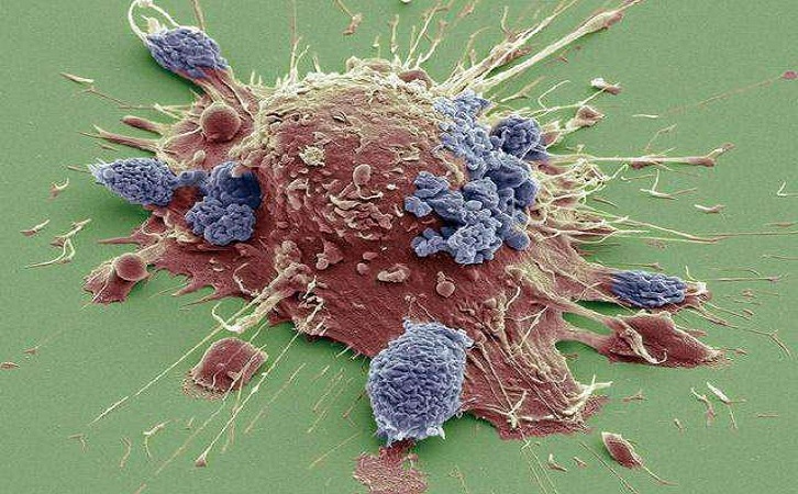 肿瘤科医生许德璞:癌细胞扩散前会出现的4种常见症状要警惕-许德璞