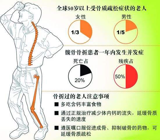皮质激素绝经过早的女性70岁以上的老年人骨质疏松的高危因素脊柱变形