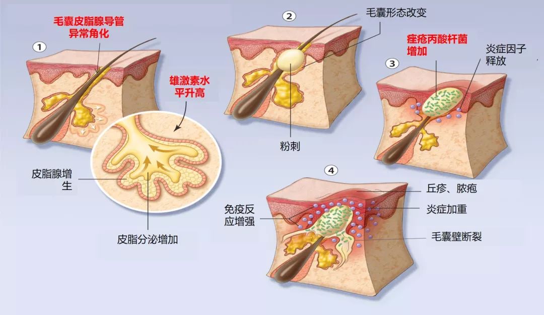 果酸换肤产品哪个好_果酸换肤产品_果酸换肤产品排行榜