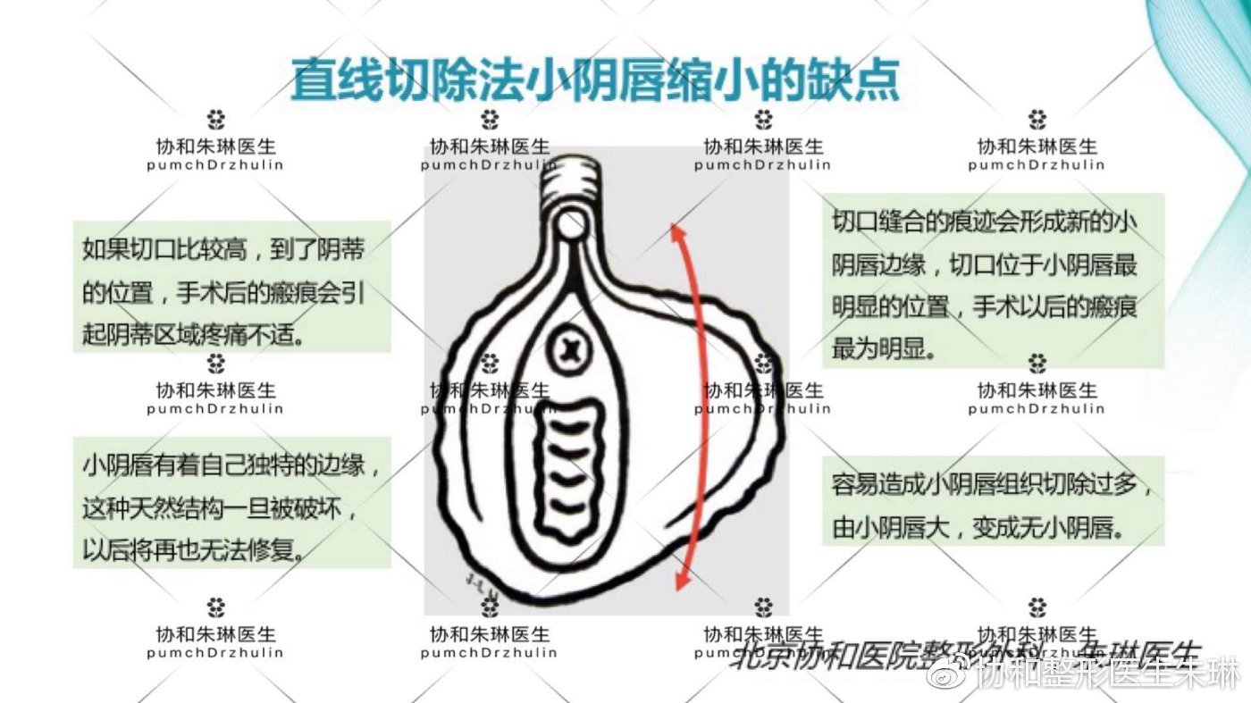 羞羞的私密话题悄悄说,听协和朱琳医生讲私密那些事