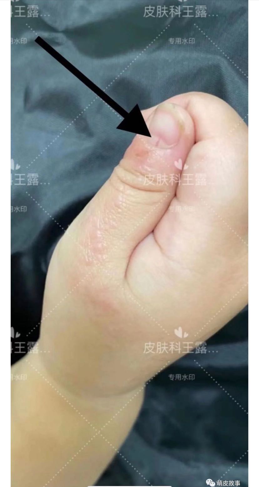 线状苔藓的一生