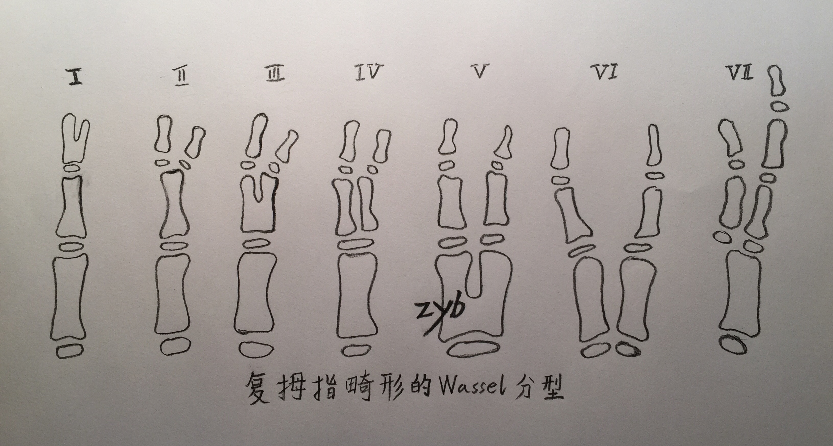 多指畸形,六指畸形,并指畸形_大山谷图库