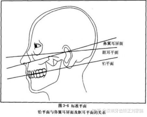 颌顶位图片