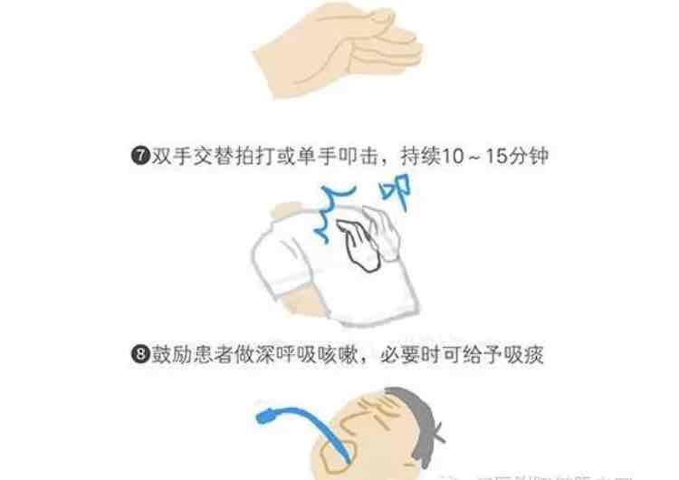 拍背排痰的方法