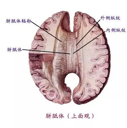 胼胝体位置图片图片