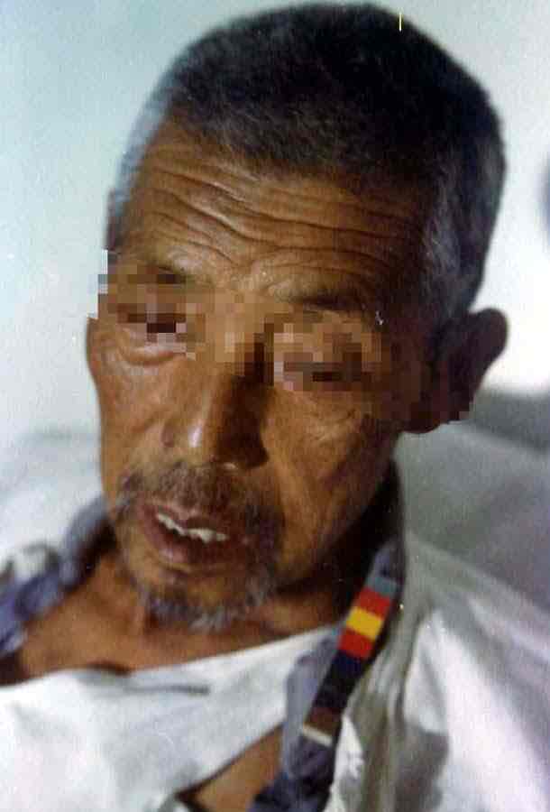 【肾虚的人为什么面色黧黑?】