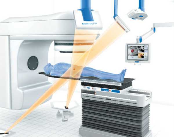 第一,放疗是用x线,伽马射线等放射线,对