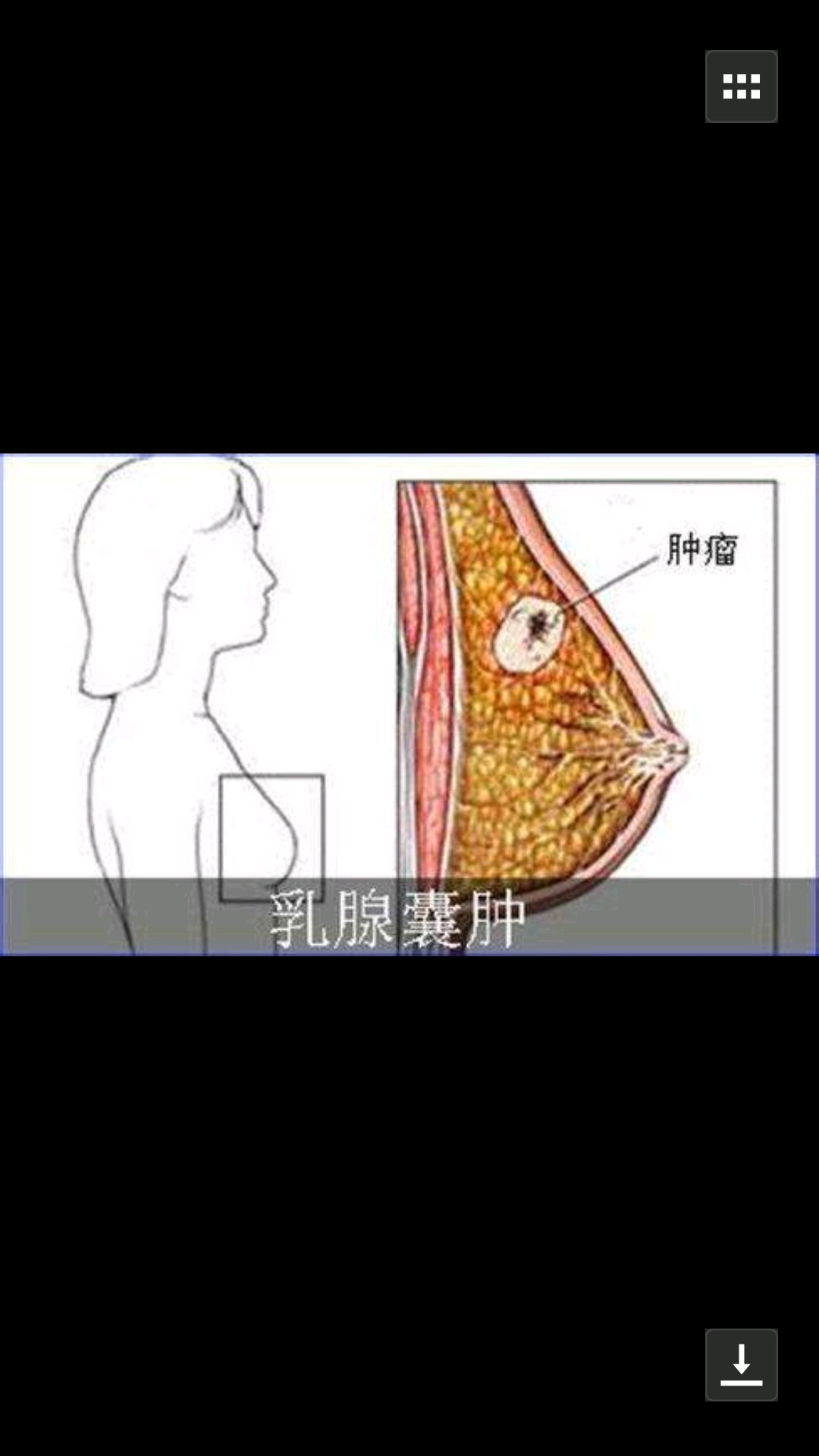 一个乳腺小手术大夫眼睛为什么却被喷了水