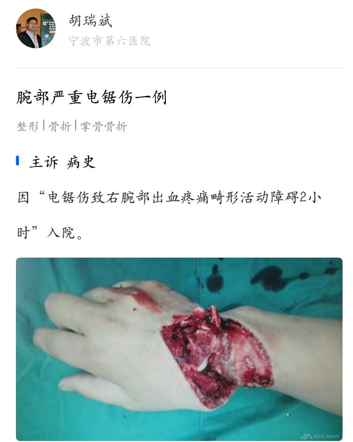 女生手腕流血真实图片图片