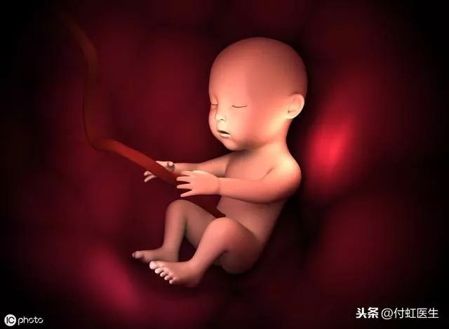 39周胎儿图片