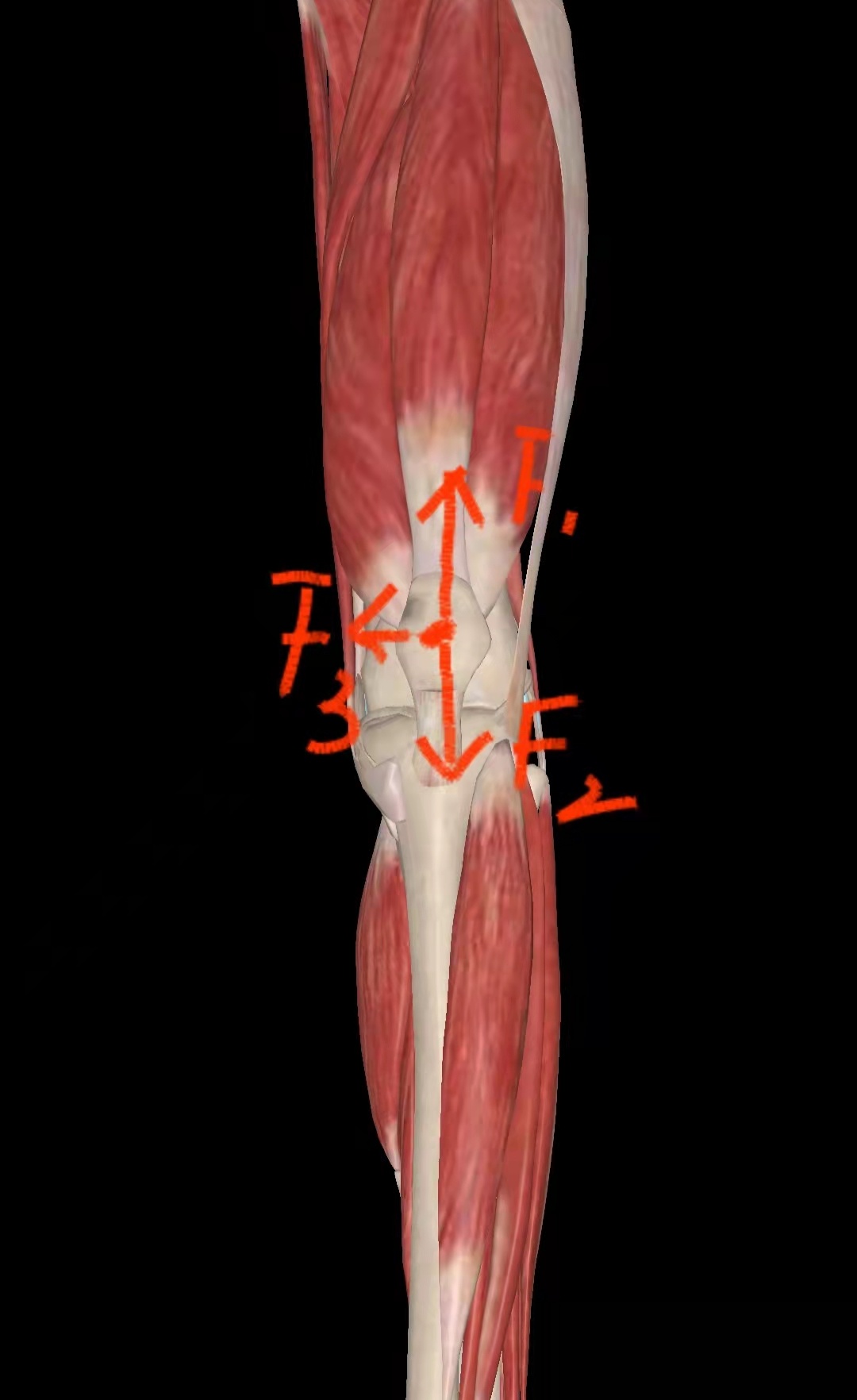 頭肌向上的拉力f1,髕腱向下的拉力f2,股骨滑車給髕骨向內側的支持力f3