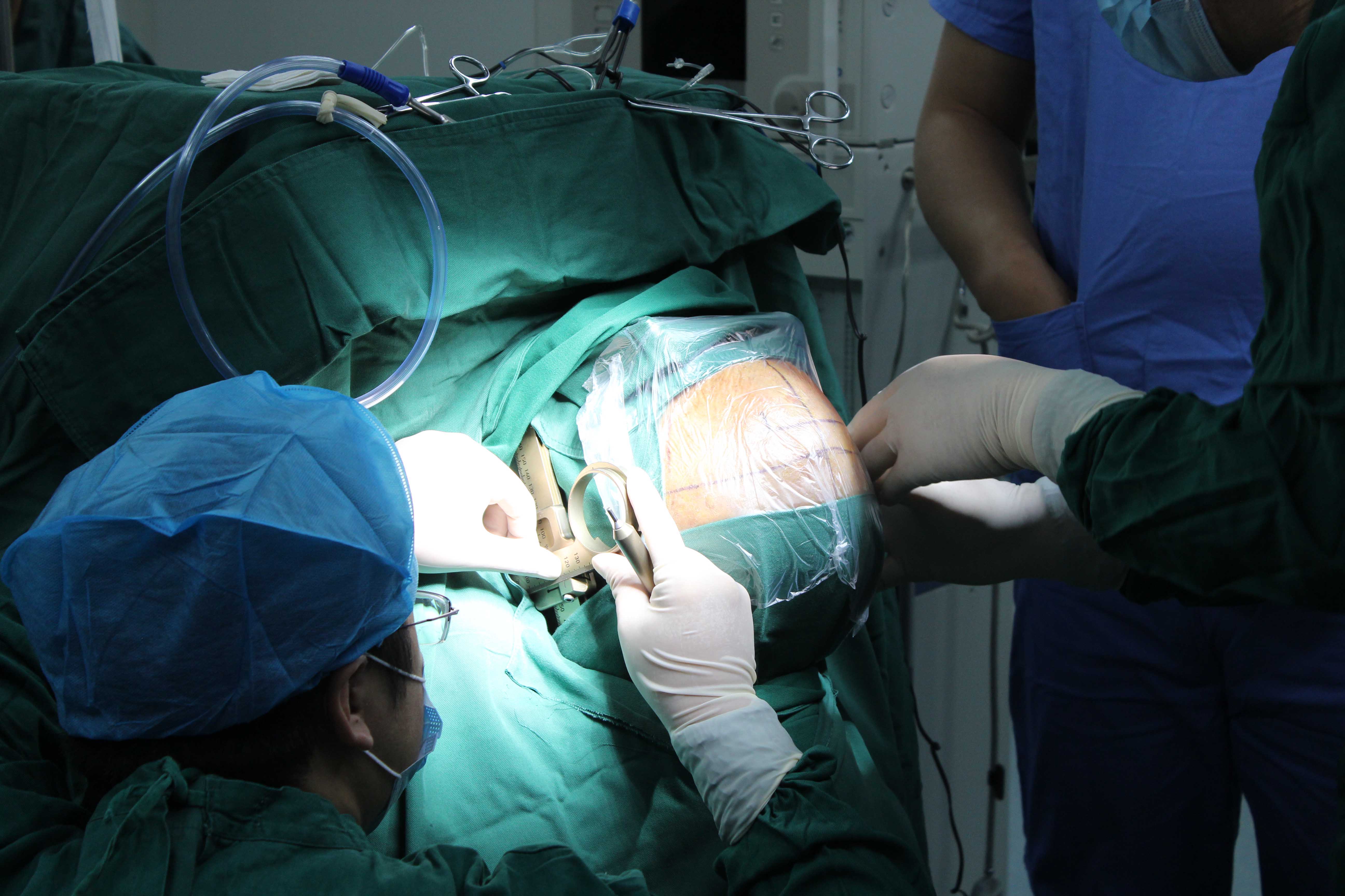 起搏器手术过程图片