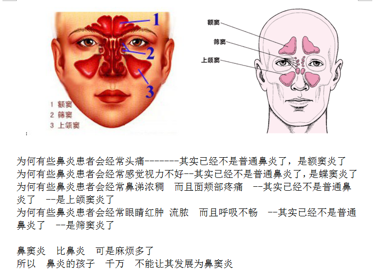 鼻窦炎头痛位置图解图片