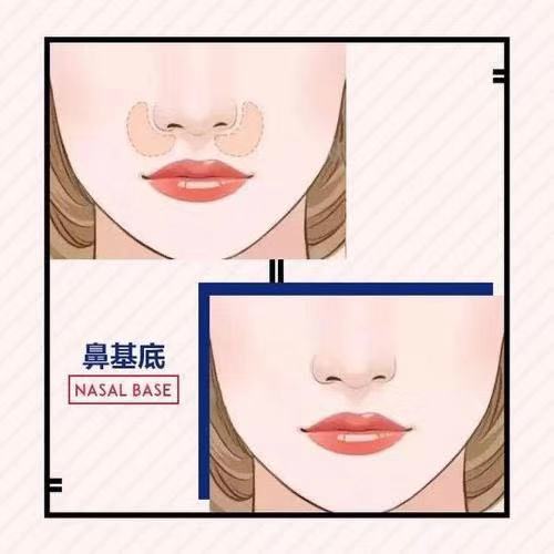 什么是鼻基底?