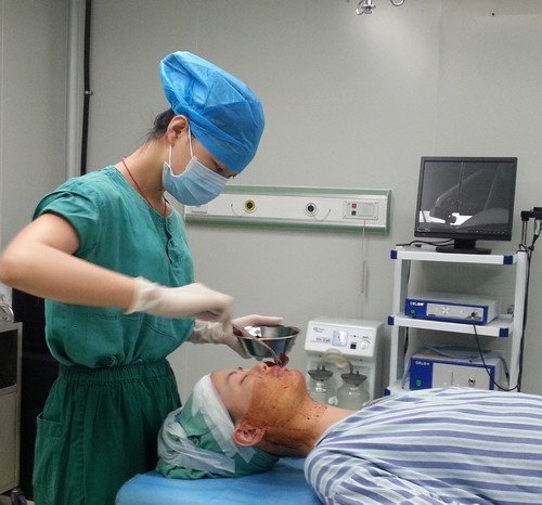 磨骨瘦脸下颌角手术:术前,术中感受(附真实案例图片)