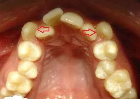 口腔清洁会用牙线还不够有完没完啊