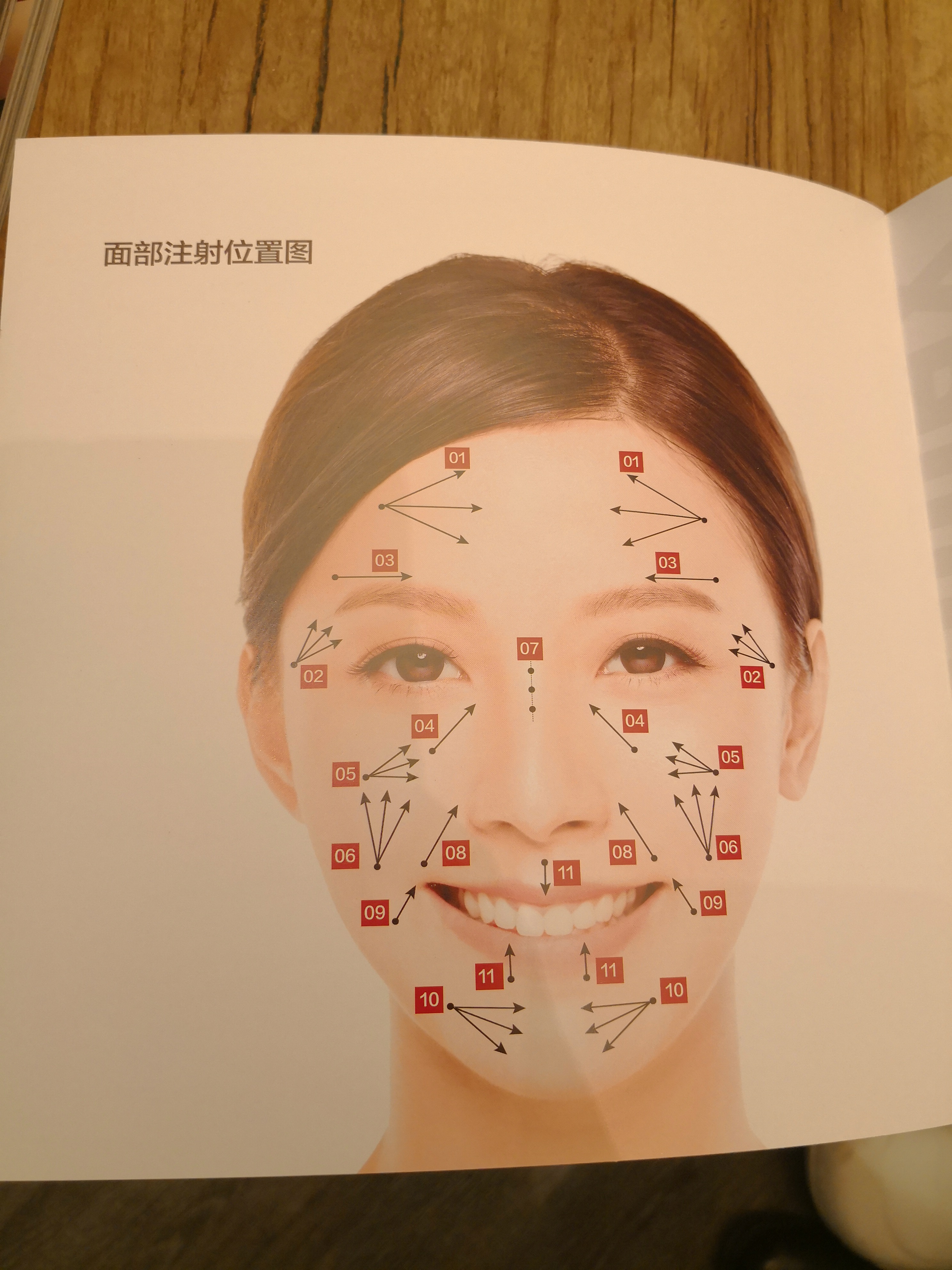 瘦脸针安全区域示意图图片