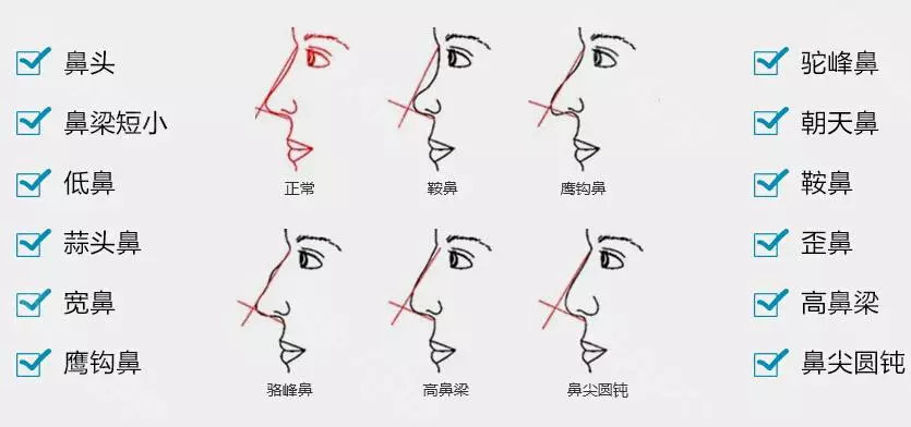 鼻子的种类,鼻子种类图片大全_大山谷图库