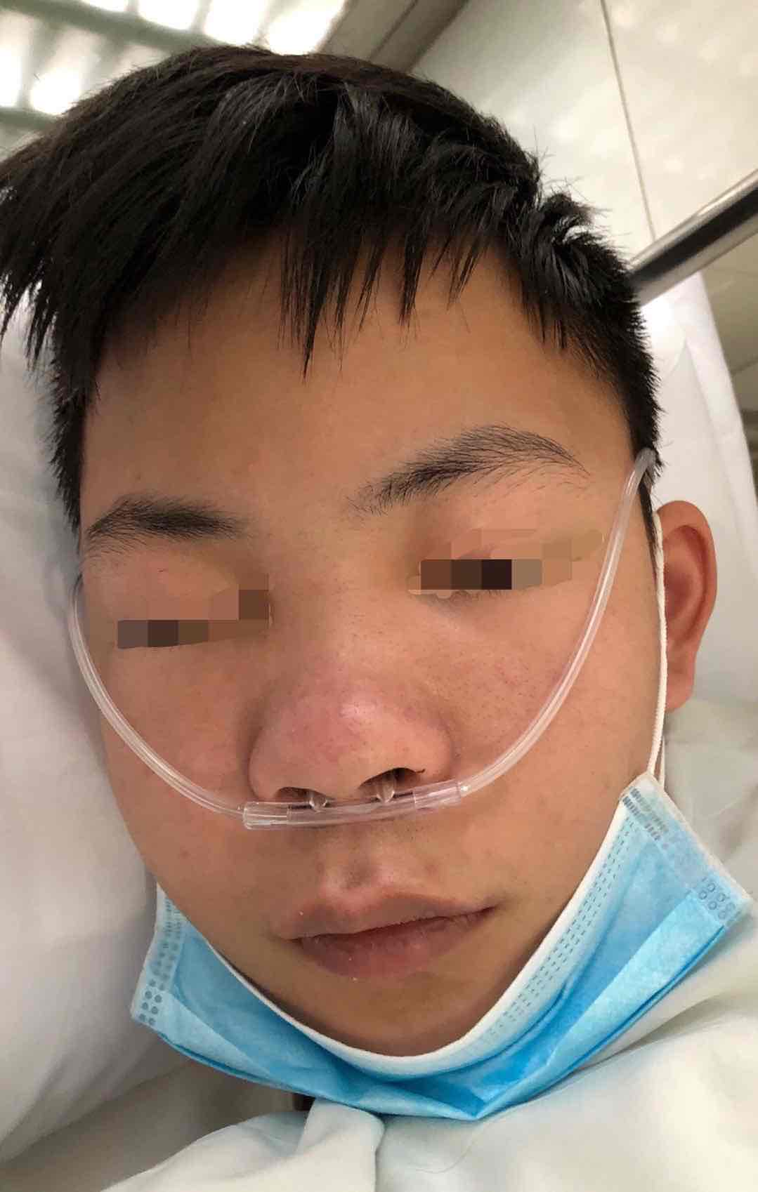 17岁少年突然变胖,原来是得了肾病!