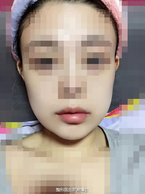 《金刚腮覆灭记》——现在简直美炸天!