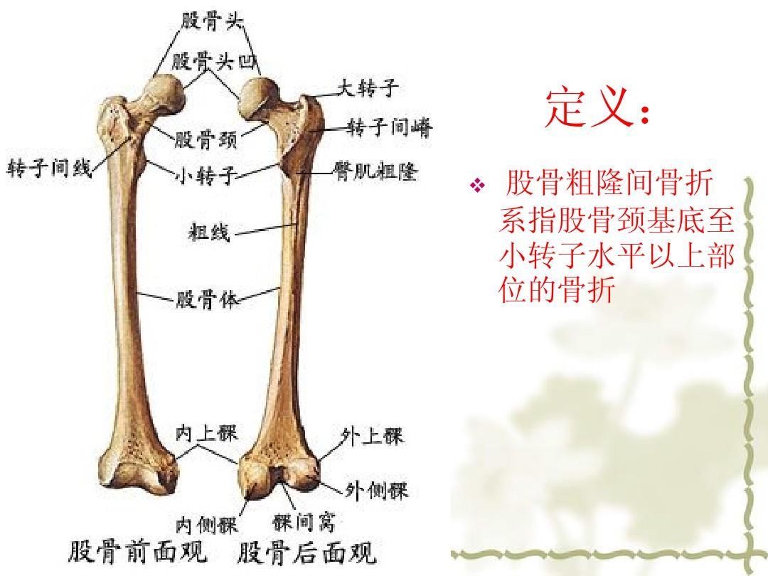 股骨粗隆间解剖位置图图片