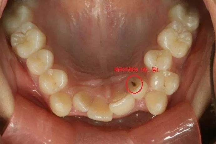 口腔清洁会用牙线还不够有完没完啊