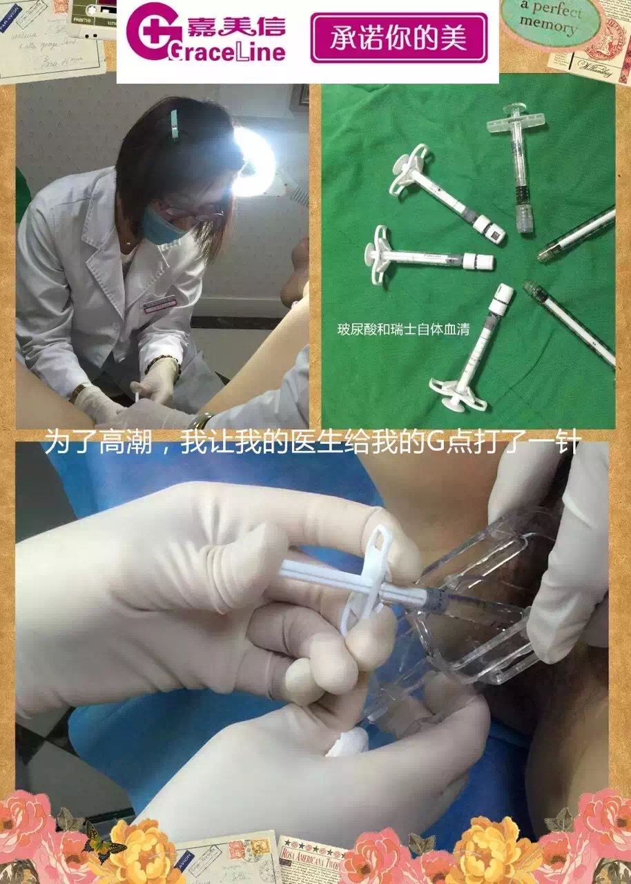 g点注射,提高私密敏感度-叶文珏副主任医师-爱问医生