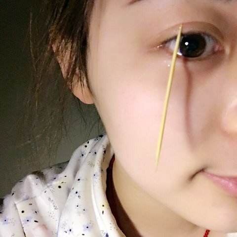 如果没有双眼皮的,也拿牙签比划下,看看什么宽度的双眼皮自我感觉最