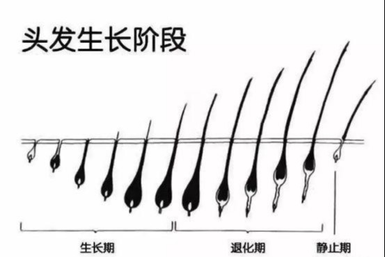 每天掉多少头发算是正常?