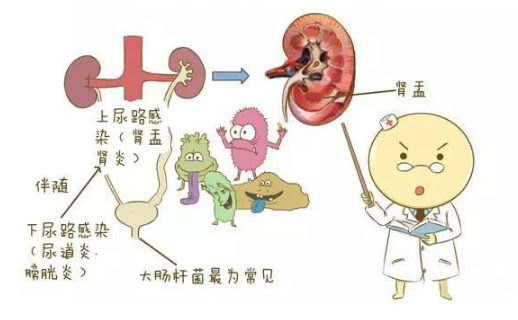 女性膀胱炎吃什么药治疗效果明显 程敏 爱问医生