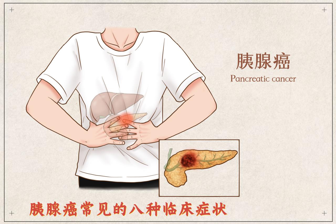 “隐藏高手”胰腺癌的新出路——微生物__中国医疗