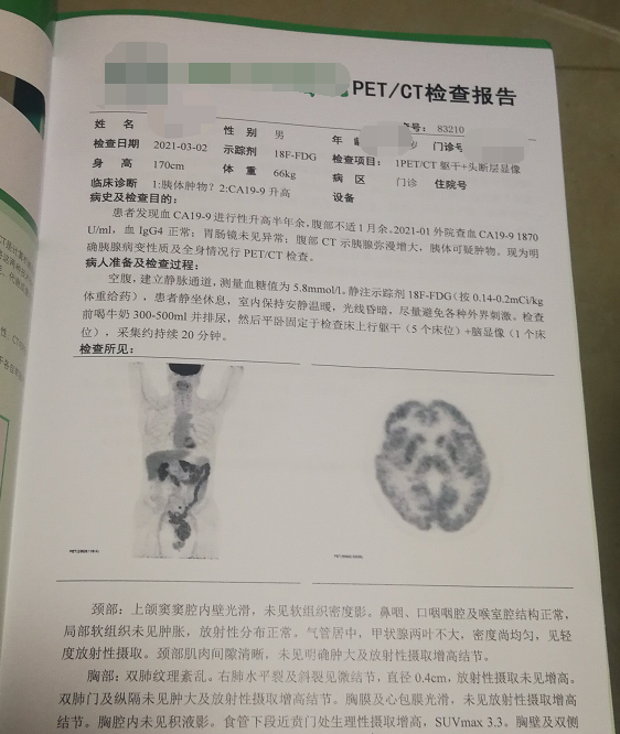 胰腺癌的ct图片与报告图片