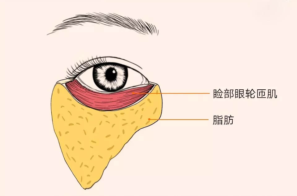 如图所示,靠近的眼睑的位置是睑部眼轮匝肌,被韧带隔开为半圆;外圈是