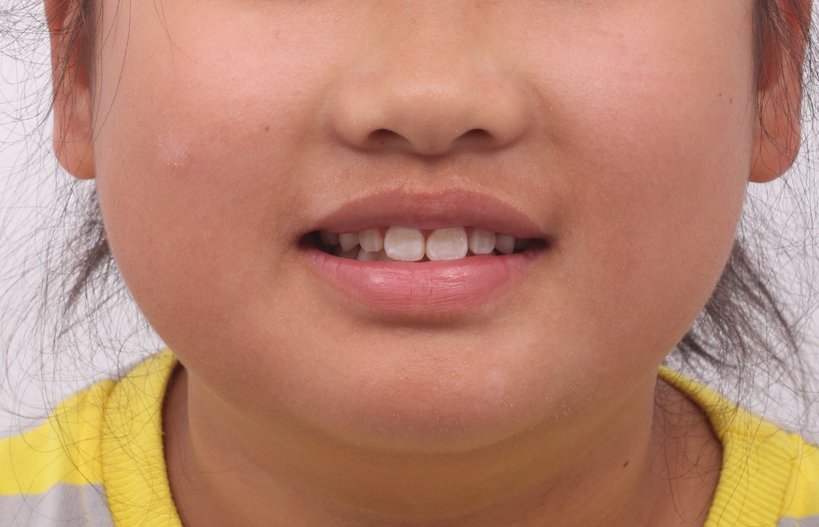 牙齿生长时间顺序图，宝宝长牙期间多久可以完全长出来牙齿为什么