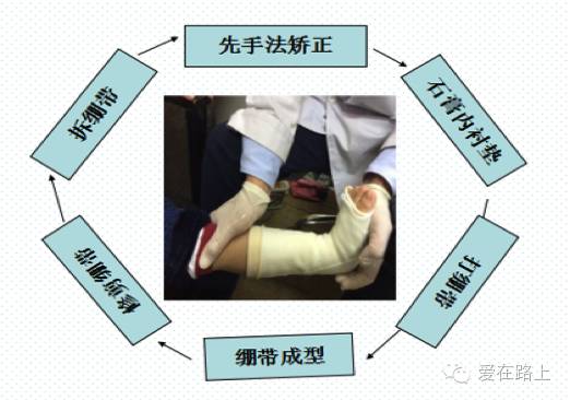 【建言献策】尖足的处理